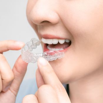 Clear Aligners Near Me in Royal Palm Beach, West Palm Beach, Palm Beach Gardens, and Lantana, FL