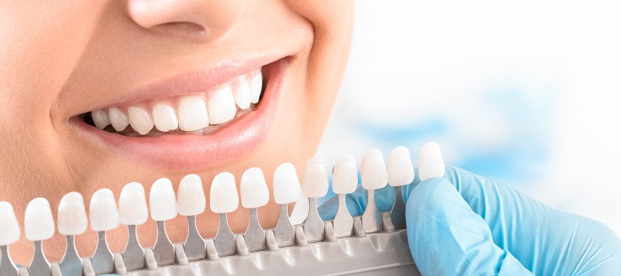 Post: How Much Do Dental Implants Cost? Everything You Need to Know Post: How Much Do Dental Implants Cost? Everything You Need to Know