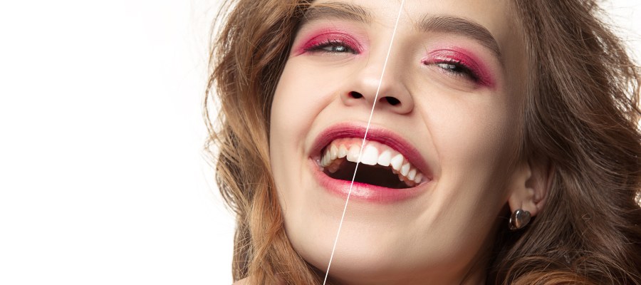 Post: Many Options For Cosmetic Dentistry Palm Beach County Post: Many Options For Cosmetic Dentistry Palm Beach County