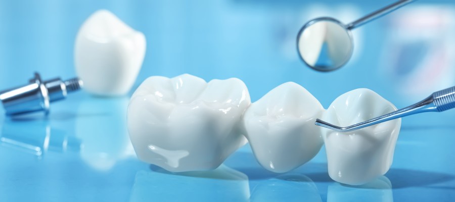 Post: Common Dental Crown Problems & Their Prevention Post: Common Dental Crown Problems & Their Prevention