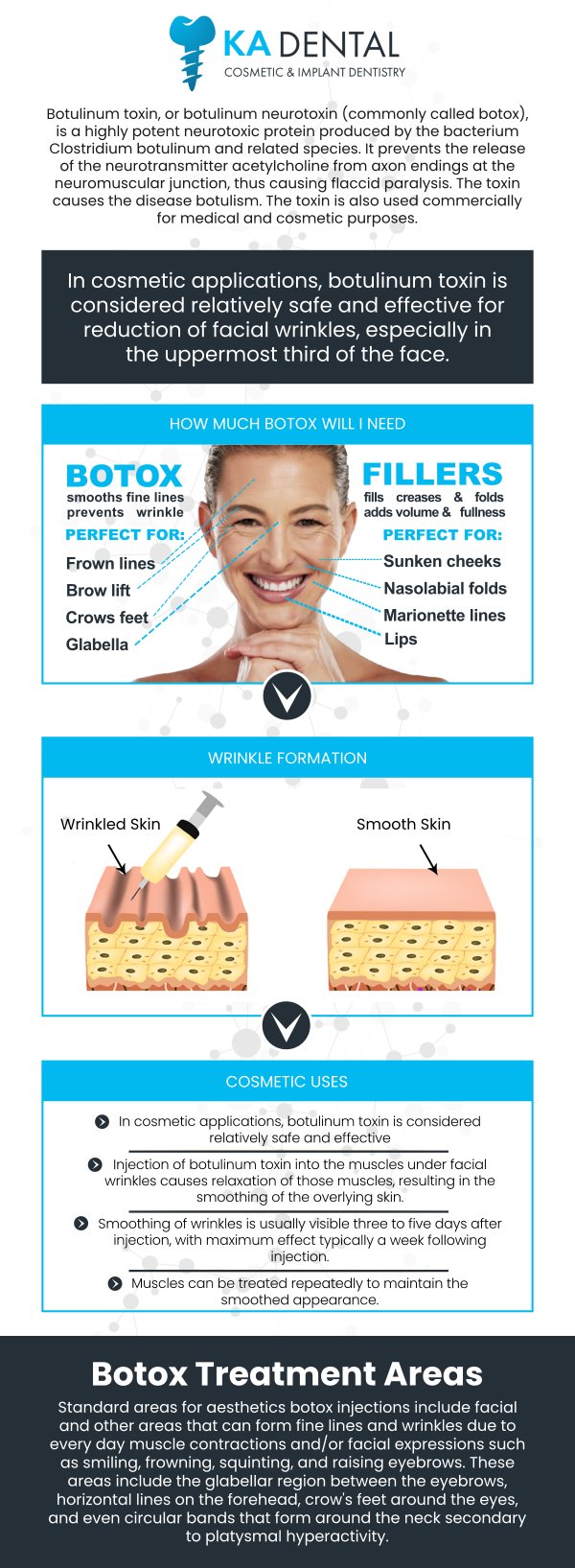 Many dental professionals, including our team at KA Dental, are now offering Botox injections as part of their services. With specialized training in facial anatomy, dentists can administer Botox safely and effectively, ensuring a smoother, more youthful appearance and improved quality of life. For more information, contact us or request an appointment online. We have convenient locations to serve you in Royal Palm Beach, West Palm Beach, Palm Beach Gardens, and Lantana, FL. Many dental professionals, including our team at KA Dental, are now offering Botox injections as part of their services. With specialized training in facial anatomy, dentists can administer Botox safely and effectively, ensuring a smoother, more youthful appearance and improved quality of life. For more information, contact us or request an appointment online. We have convenient locations to serve you in Royal Palm Beach, West Palm Beach, Palm Beach Gardens, and Lantana, FL.