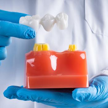 Dental Bridges Near Me in Royal Palm Beach, West Palm Beach, Palm Beach Gardens, and Lantana, FL