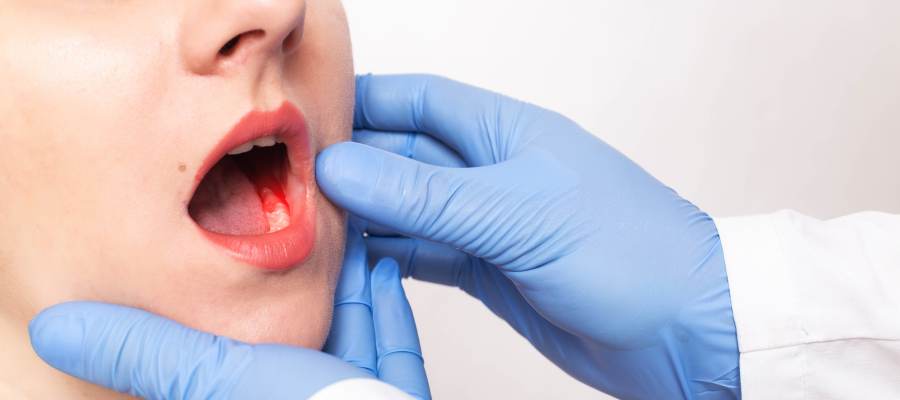 Periodontal Disease Treatment Specialist in Royal Palm Beach, West Palm Beach, Palm Beach Gardens, and Lantana, FL Periodontal Disease Treatment Specialist in Royal Palm Beach, West Palm Beach, Palm Beach Gardens, and Lantana, FL
