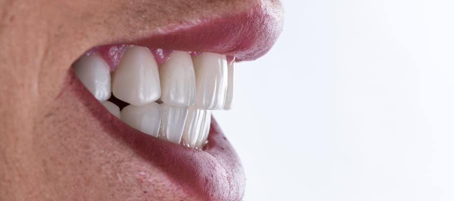 Cosmetic Crowns Specialist Near Me in Royal Palm Beach, West Palm Beach, Palm Beach Gardens, and Lantana, FL Cosmetic Crowns Specialist Near Me in Royal Palm Beach, West Palm Beach, Palm Beach Gardens, and Lantana, FL