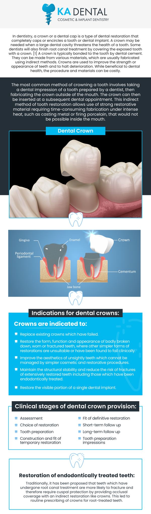 Dental crowns are a reliable solution for restoring damaged or weakened teeth. Our experienced team offers durable, natural-looking crowns that provide strength and protection while improving the appearance of your smile. Whether you need a crown due to decay, a cracked tooth, or after a root canal, we provide high-quality, custom-made crowns for long-lasting results. For more information, contact us or schedule an appointment online. We are conveniently located at 9810 Highway A1A Alternate, #106, Palm Beach Gardens, FL 33410. Dental crowns are a reliable solution for restoring damaged or weakened teeth. Our experienced team offers durable, natural-looking crowns that provide strength and protection while improving the appearance of your smile. Whether you need a crown due to decay, a cracked tooth, or after a root canal, we provide high-quality, custom-made crowns for long-lasting results. For more information, contact us or schedule an appointment online. We are conveniently located at 9810 Highway A1A Alternate, #106, Palm Beach Gardens, FL 33410.