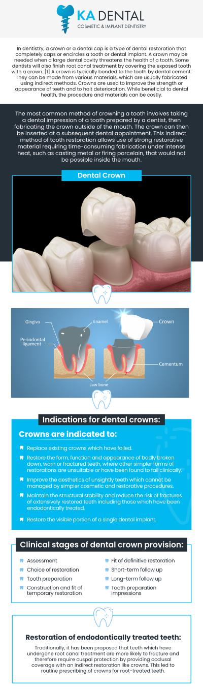 Dental crowns are a reliable solution for restoring damaged or weakened teeth. Our experienced team offers durable, natural-looking crowns that provide strength and protection while improving the appearance of your smile. Whether you need a crown due to decay, a cracked tooth, or after a root canal, we provide high-quality, custom-made crowns for long-lasting results. For more information, contact us or schedule an appointment online. We are conveniently located at 9810 Highway A1A Alternate, #106, Palm Beach Gardens, FL 33410. Dental crowns are a reliable solution for restoring damaged or weakened teeth. Our experienced team offers durable, natural-looking crowns that provide strength and protection while improving the appearance of your smile. Whether you need a crown due to decay, a cracked tooth, or after a root canal, we provide high-quality, custom-made crowns for long-lasting results. For more information, contact us or schedule an appointment online. We are conveniently located at 9810 Highway A1A Alternate, #106, Palm Beach Gardens, FL 33410.