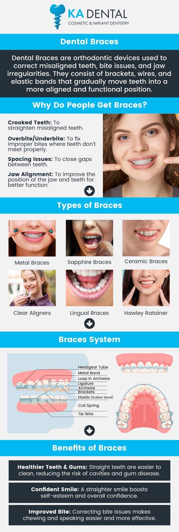 Dental braces are corrective orthodontic devices used to align and straighten teeth, improving both the appearance and function of a person's bite. they apply continuous, gentle pressure over time to gradually shift teeth into their correct positions. This process helps to resolve a range of dental issues, including overcrowding, crooked teeth, and malocclusions, ultimately leading to a healthier and more confident smile. Consult Dr. Aditi Patel, BDS, DDS and Dr. Krunal Patel, BDS, DDS, FICOI to ensures a personalized treatment plan, proper fitting, and ongoing monitoring for optimal results. For more information, contact us or request an appointment online. We have convenient locations to serve you in Royal Palm Beach, West Palm Beach, Palm Beach Gardens, and Lantana, FL. Dental braces are corrective orthodontic devices used to align and straighten teeth, improving both the appearance and function of a person's bite. they apply continuous, gentle pressure over time to gradually shift teeth into their correct positions. This process helps to resolve a range of dental issues, including overcrowding, crooked teeth, and malocclusions, ultimately leading to a healthier and more confident smile. Consult Dr. Aditi Patel, BDS, DDS and Dr. Krunal Patel, BDS, DDS, FICOI to ensures a personalized treatment plan, proper fitting, and ongoing monitoring for optimal results. For more information, contact us or request an appointment online. We have convenient locations to serve you in Royal Palm Beach, West Palm Beach, Palm Beach Gardens, and Lantana, FL.