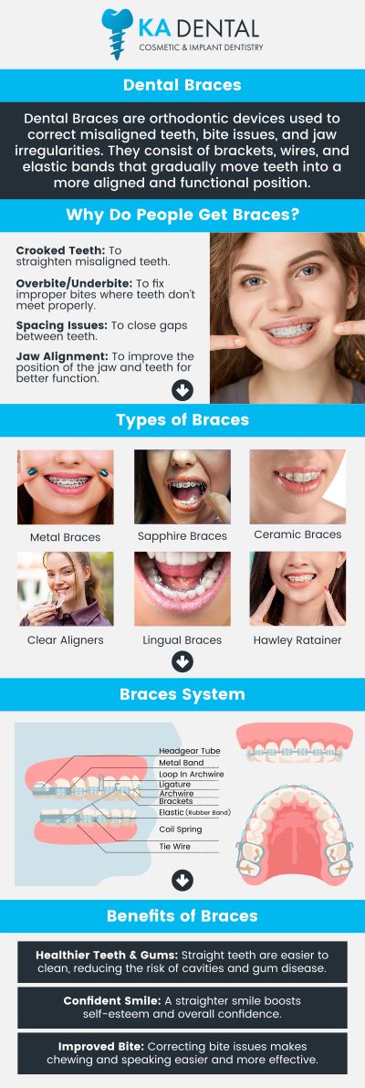 Dental braces are corrective orthodontic devices used to align and straighten teeth, improving both the appearance and function of a person's bite. they apply continuous, gentle pressure over time to gradually shift teeth into their correct positions. This process helps to resolve a range of dental issues, including overcrowding, crooked teeth, and malocclusions, ultimately leading to a healthier and more confident smile. Consult Dr. Aditi Patel, BDS, DDS and Dr. Krunal Patel, BDS, DDS, FICOI to ensures a personalized treatment plan, proper fitting, and ongoing monitoring for optimal results. For more information, contact us or request an appointment online. We have convenient locations to serve you in Royal Palm Beach, West Palm Beach, Palm Beach Gardens, and Lantana, FL. Dental braces are corrective orthodontic devices used to align and straighten teeth, improving both the appearance and function of a person's bite. they apply continuous, gentle pressure over time to gradually shift teeth into their correct positions. This process helps to resolve a range of dental issues, including overcrowding, crooked teeth, and malocclusions, ultimately leading to a healthier and more confident smile. Consult Dr. Aditi Patel, BDS, DDS and Dr. Krunal Patel, BDS, DDS, FICOI to ensures a personalized treatment plan, proper fitting, and ongoing monitoring for optimal results. For more information, contact us or request an appointment online. We have convenient locations to serve you in Royal Palm Beach, West Palm Beach, Palm Beach Gardens, and Lantana, FL.
