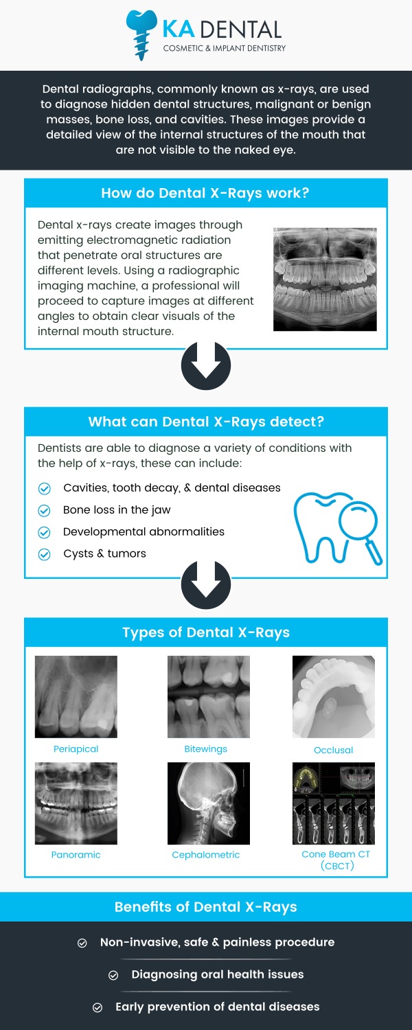 Dental X-rays are a vital diagnostic tool that allows dentists to examine the health of your teeth, gums, and jawbone. They help identify issues such as cavities, infections, and bone loss that may not be visible during a regular exam. Visit our team of professionals for early detection and timely treatment, helping to maintain optimal oral health. For more information, contact us or request an appointment online. We have convenient locations to serve you in Royal Palm Beach, West Palm Beach, Palm Beach Gardens, and Lantana, FL. Dental X-rays are a vital diagnostic tool that allows dentists to examine the health of your teeth, gums, and jawbone. They help identify issues such as cavities, infections, and bone loss that may not be visible during a regular exam. Visit our team of professionals for early detection and timely treatment, helping to maintain optimal oral health. For more information, contact us or request an appointment online. We have convenient locations to serve you in Royal Palm Beach, West Palm Beach, Palm Beach Gardens, and Lantana, FL.