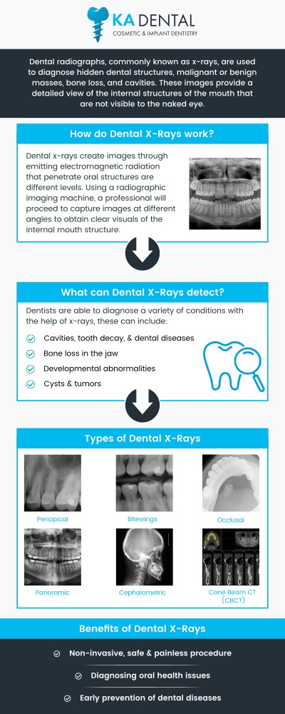Dental X-rays are a vital diagnostic tool that allows dentists to examine the health of your teeth, gums, and jawbone. They help identify issues such as cavities, infections, and bone loss that may not be visible during a regular exam. Visit our team of professionals for early detection and timely treatment, helping to maintain optimal oral health. For more information, contact us or request an appointment online. We have convenient locations to serve you in Royal Palm Beach, West Palm Beach, Palm Beach Gardens, and Lantana, FL. Dental X-rays are a vital diagnostic tool that allows dentists to examine the health of your teeth, gums, and jawbone. They help identify issues such as cavities, infections, and bone loss that may not be visible during a regular exam. Visit our team of professionals for early detection and timely treatment, helping to maintain optimal oral health. For more information, contact us or request an appointment online. We have convenient locations to serve you in Royal Palm Beach, West Palm Beach, Palm Beach Gardens, and Lantana, FL.