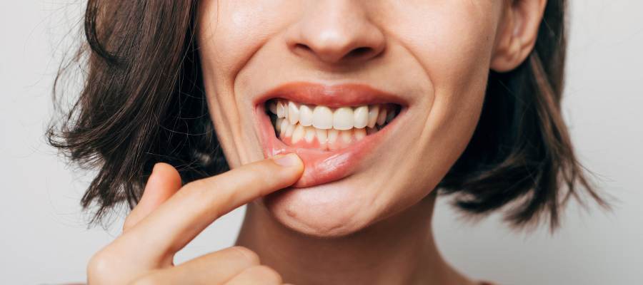 Laser Gum Contouring in Royal Palm Beach, West Palm Beach, Palm Beach Gardens, and Lantana, FL Laser Gum Contouring in Royal Palm Beach, West Palm Beach, Palm Beach Gardens, and Lantana, FL