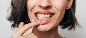 Laser Gum Contouring in Royal Palm Beach, West Palm Beach, Palm Beach Gardens, and Lantana, FL Laser Gum Contouring in Royal Palm Beach, West Palm Beach, Palm Beach Gardens, and Lantana, FL