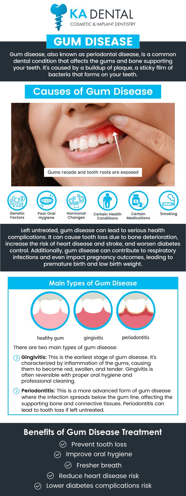 Dr. Aditi Patel, BDS, DDS and Dr. Krunal Patel, BDS, DDS, FICOI are dedicated to providing comprehensive care for patients suffering from gum disease. We offer advanced treatments to reduce inflammation, fight infection, and promote gum healing. For more information, contact us or request an appointment online. We have convenient locations in Royal Palm Beach, West Palm Beach, Palm Beach Gardens, and Lantana, FL. Dr. Aditi Patel, BDS, DDS and Dr. Krunal Patel, BDS, DDS, FICOI are dedicated to providing comprehensive care for patients suffering from gum disease. We offer advanced treatments to reduce inflammation, fight infection, and promote gum healing. For more information, contact us or request an appointment online. We have convenient locations in Royal Palm Beach, West Palm Beach, Palm Beach Gardens, and Lantana, FL.