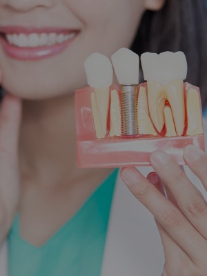 Implants Near Me in Royal Palm Beach, West Palm Beach, Palm Beach Gardens, and Lantana, FL Implants Near Me in Royal Palm Beach, West Palm Beach, Palm Beach Gardens, and Lantana, FL