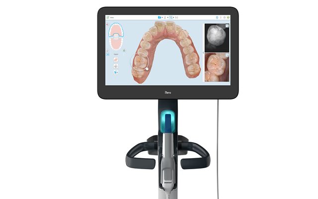The Future of Dental Impressions - iTero The Future of Dental Impressions - iTero