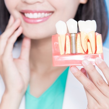 Implants Near Me in Royal Palm Beach, West Palm Beach, Palm Beach Gardens, and Lantana, FL