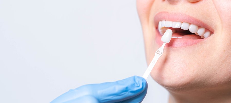 Porcelain Veneers Specialist Near Me in Royal Palm Beach, West Palm Beach, Palm Beach Gardens, and Lantana, FL Porcelain Veneers Specialist Near Me in Royal Palm Beach, West Palm Beach, Palm Beach Gardens, and Lantana, FL
