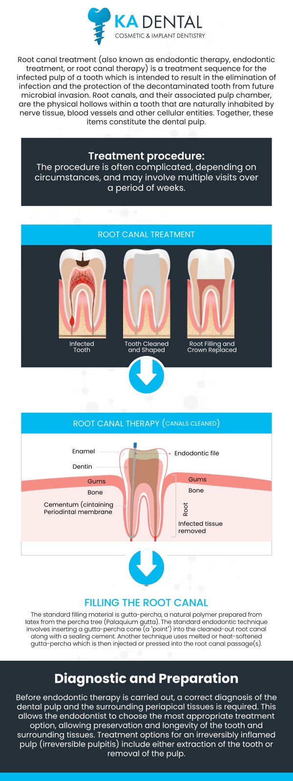 At KA Dental, Dr. Krunal Patel, BDS, DDS, FICOI, and Dr. Aditi Patel, BDS, DDS, are committed to providing top-notch care for your dental needs. By addressing the problem early, we help preserve your natural tooth, preventing the need for extraction. Let us help restore comfort and function to your smile with professional root canal treatment tailored to your needs. For more information, contact us or request an appointment online. We have convenient locations in Royal Palm Beach, West Palm Beach, Palm Beach Gardens, and Lantana, FL. At KA Dental, Dr. Krunal Patel, BDS, DDS, FICOI, and Dr. Aditi Patel, BDS, DDS, are committed to providing top-notch care for your dental needs. By addressing the problem early, we help preserve your natural tooth, preventing the need for extraction. Let us help restore comfort and function to your smile with professional root canal treatment tailored to your needs. For more information, contact us or request an appointment online. We have convenient locations in Royal Palm Beach, West Palm Beach, Palm Beach Gardens, and Lantana, FL.