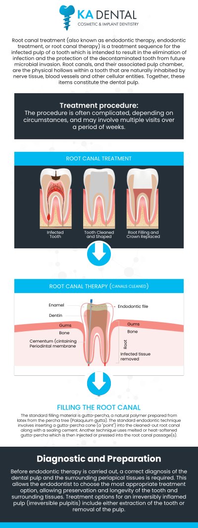 At KA Dental, Dr. Krunal Patel, BDS, DDS, FICOI, and Dr. Aditi Patel, BDS, DDS, are committed to providing top-notch care for your dental needs. By addressing the problem early, we help preserve your natural tooth, preventing the need for extraction. Let us help restore comfort and function to your smile with professional root canal treatment tailored to your needs. For more information, contact us or request an appointment online. We have convenient locations in Royal Palm Beach, West Palm Beach, Palm Beach Gardens, and Lantana, FL. At KA Dental, Dr. Krunal Patel, BDS, DDS, FICOI, and Dr. Aditi Patel, BDS, DDS, are committed to providing top-notch care for your dental needs. By addressing the problem early, we help preserve your natural tooth, preventing the need for extraction. Let us help restore comfort and function to your smile with professional root canal treatment tailored to your needs. For more information, contact us or request an appointment online. We have convenient locations in Royal Palm Beach, West Palm Beach, Palm Beach Gardens, and Lantana, FL.