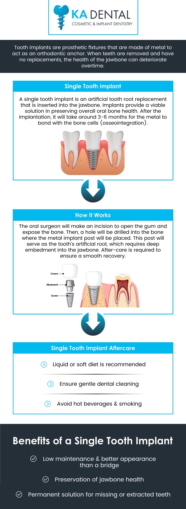Common questions asked by patients: What is a single tooth implant, and how does it work? How long does it take to recover from a single tooth implant procedure? Am I a good candidate for a single tooth implant? How much does a single tooth implant cost? For more information, contact us or schedule an appointment online. We are conveniently located at 9810 Highway A1A Alternate, #106, Palm Beach Gardens, FL 33410. We serve patients from Palm Beach Gardens FL, Riviera Beach FL, Juno Beach FL, Jupiter FL, West Palm Beach FL, and surrounding areas. Common questions asked by patients: What is a single tooth implant, and how does it work? How long does it take to recover from a single tooth implant procedure? Am I a good candidate for a single tooth implant? How much does a single tooth implant cost? For more information, contact us or schedule an appointment online. We are conveniently located at 9810 Highway A1A Alternate, #106, Palm Beach Gardens, FL 33410. We serve patients from Palm Beach Gardens FL, Riviera Beach FL, Juno Beach FL, Jupiter FL, West Palm Beach FL, and surrounding areas.