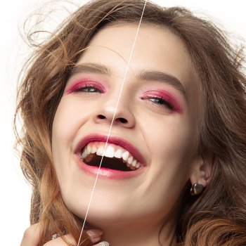 Teeth Cleanings Near Me in Royal Palm Beach, West Palm Beach, Palm Beach Gardens, and Lantana, FL