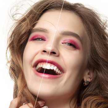 Teeth Cleanings Near Me in Royal Palm Beach, West Palm Beach, Palm Beach Gardens, and Lantana, FL