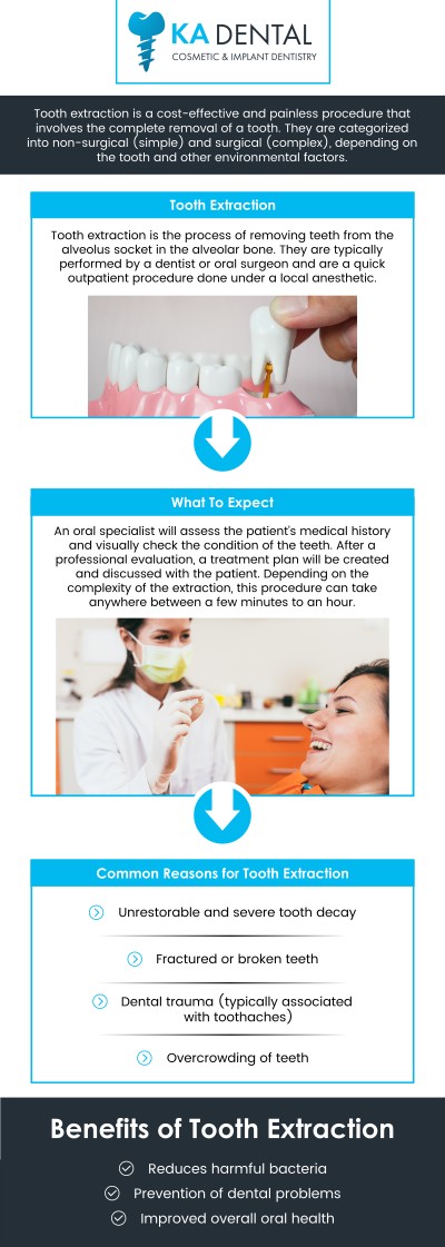 Common questions asked by patients: What is the tooth extraction process at KA Dental? What should I expect during my tooth extraction appointment? Who is a candidate for tooth extraction? What are alternatives to tooth extraction? For more information, contact us or schedule an appointment online. We are conveniently located at 9810 Highway A1A Alternate, #106, Palm Beach Gardens, FL 33410. We serve patients from Palm Beach Gardens FL, Riviera Beach FL, Juno Beach FL, Jupiter FL, West Palm Beach FL, and surrounding areas. Common questions asked by patients: What is the tooth extraction process at KA Dental? What should I expect during my tooth extraction appointment? Who is a candidate for tooth extraction? What are alternatives to tooth extraction? For more information, contact us or schedule an appointment online. We are conveniently located at 9810 Highway A1A Alternate, #106, Palm Beach Gardens, FL 33410. We serve patients from Palm Beach Gardens FL, Riviera Beach FL, Juno Beach FL, Jupiter FL, West Palm Beach FL, and surrounding areas.