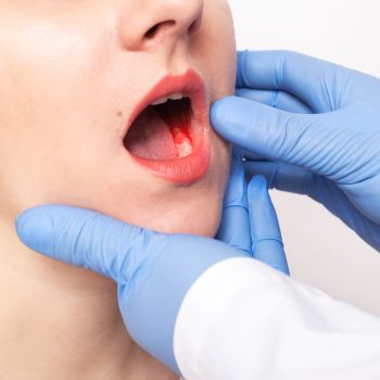 Periodontal Therapy Near Me in Royal Palm Beach, West Palm Beach, Palm Beach Gardens, and Lantana, FL