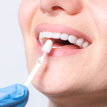 Porcelain Veneers Near Me in Royal Palm Beach, West Palm Beach, Palm Beach Gardens, and Lantana, FL