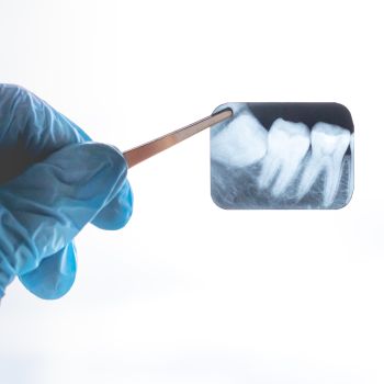 Dental X-Ray Near Me in Royal Palm Beach, West Palm Beach, Palm Beach Gardens, and Lantana, FL